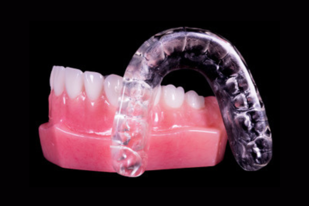 Occlusal guard deals